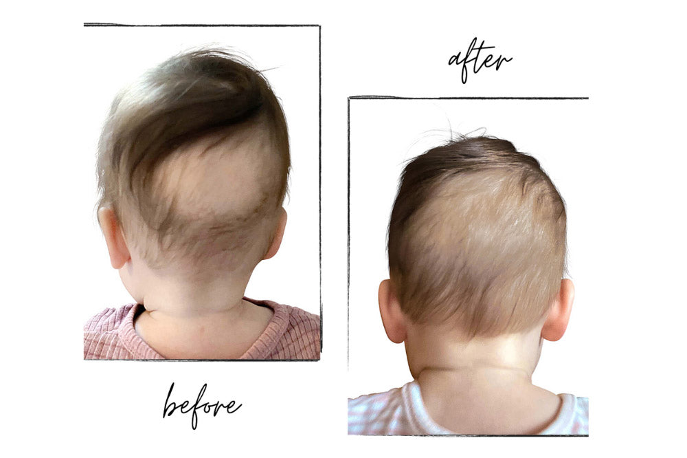 9 month old has flat spot on back of head discount